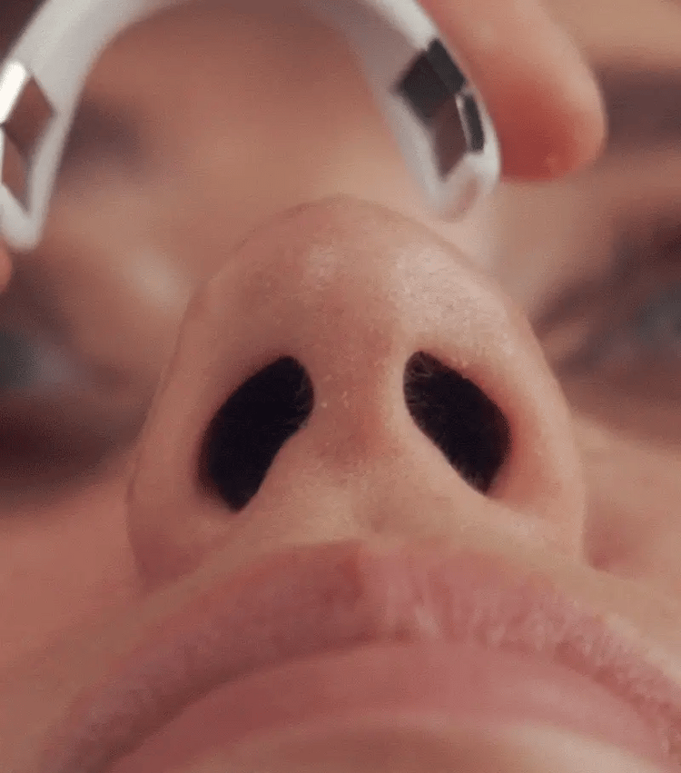Somnin™ Magnetic Nasal Strips